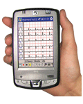 Medinhand Pocket ECG