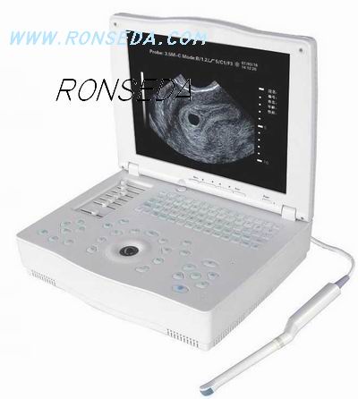 Laptop Ultrasound Scanner RSD RP6A