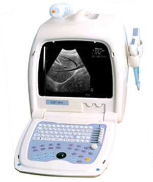 OSEN800U Portable Ultrasound Scanner