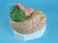 Model of human brain and its arteries, cut view